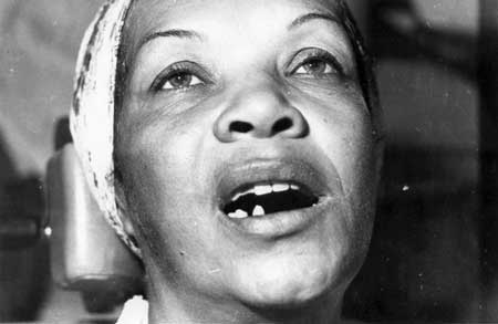 Fig.1 Marcada limitación de la apertura bucal. y desviación del mentón debida a anquilosis temporomandibular unilateral