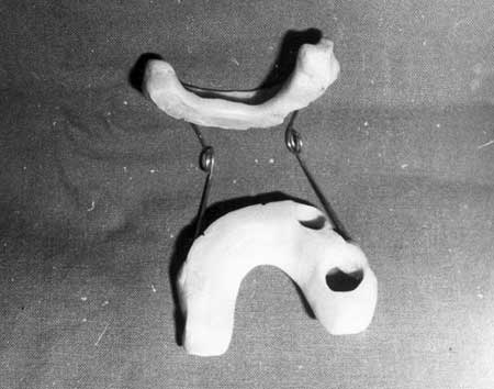 Fig.9 Estimulador para la fisioterapia