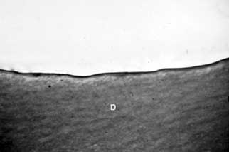 Fig: 3 Grupo III: Superficie radicular después de la remoción del ligamento periodontal. Tricromico de Masson - 63x.