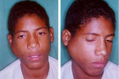 Fig. 1: A: Vista de Frente B: Vista lateral.