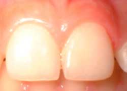 Figura 3