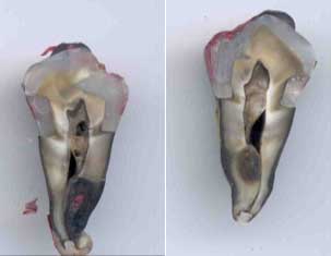 Figura 2