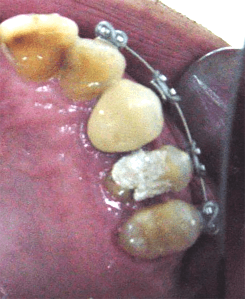 Fig. 11 Vista oclusal