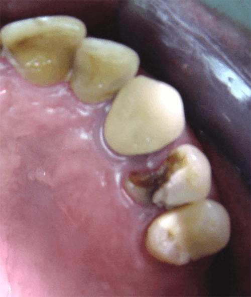 Fig. 5 Vista oclusal