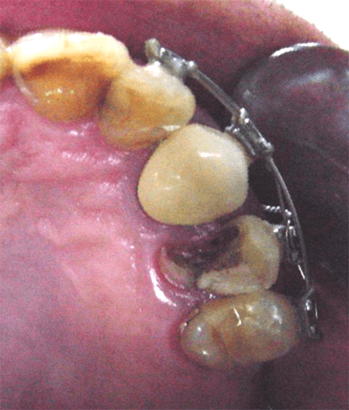 Fig. 7 Vista oclusal
