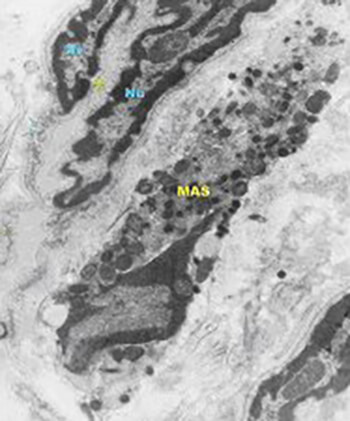 Fig. 8 En esta sección obsérvese la presencia de un capilar con un núcleo (Nu) de la célula endotelial rico en heterocromatina, con numerosas vesículas pinocíticas (cabeza de flecha), cavéolas (flecha) y prolongaciones del citoplasma hacia la luz (asterisco). La membrana basal esta ligeramente engrosada. Próximo al capilar se presenta un mastocito (MAS). Nótese la abundancia de colágeno X. 26.700