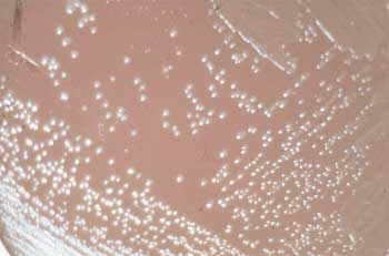 FIGURA 1 Crecimiento de colonias de N. gonorrhoeae en Agar Thayer Martín.