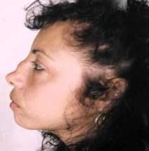 Fig. 1 Preoperatorio