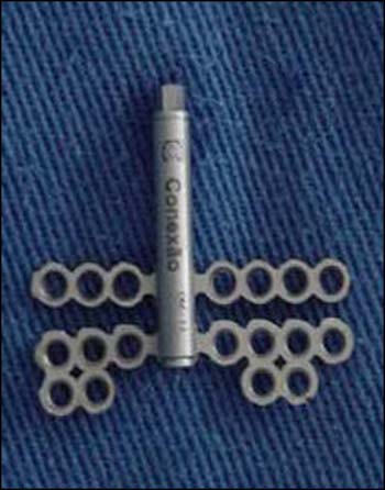 Fig. 3 Dispositivo de distracción osteogénica de la Conexão Implant System®. SP-Brasil, ya a adaptado para su colocación