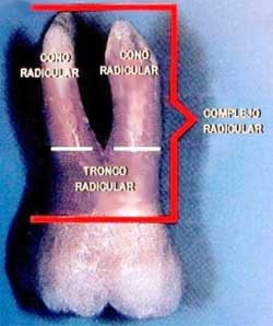 Figura 1. Complejo Radicular de un molar superior. Integrado por una región indivisa, el tronco radicular y una región dividida, los conos radiculares. Tomado de Lindhe 2000.