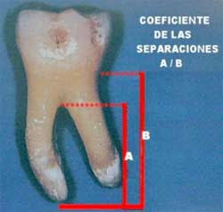 Figura 4. Coeficiente de separación (A-B) del molar inferior. Tomado de Lindhe 2000.