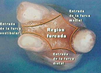 Figura 5. Vista de un molar superior con los tres conos radiculares. Tomado de Lindhe 2000.