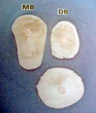 Figura 9. Forma radicular de un primer molar superior. Corte horizontal. Tomado de Lindhe 2000.