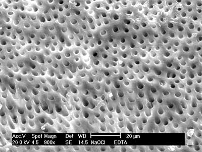 Fig. 4. NaOCl + EDTA (control positivo). Tercio Medio