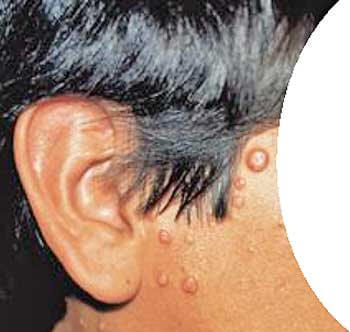 Fig1.