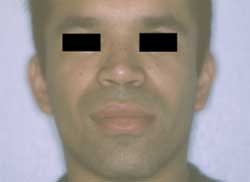 Figura 1. Aspecto extrabucal