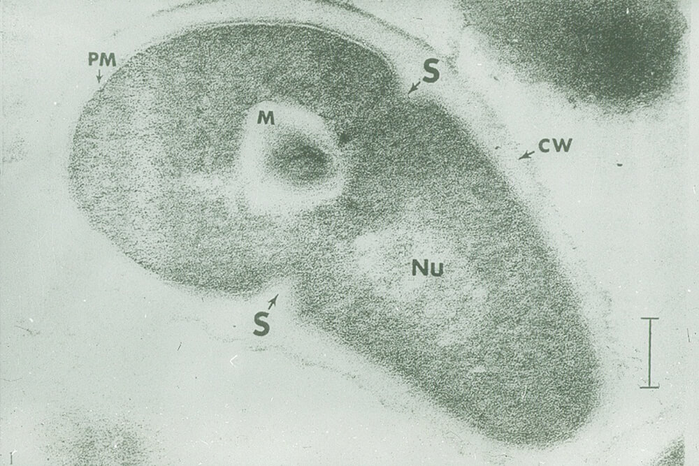 FIGURA 1: Corte de una célula cocoide de R. dentocariosa (24 horas). Se distinguen las siguientes estructuras: -S: Septo transversal; -CW: Pared celular; -PM: Membrana citoplasmática; -M: Mesosoma; -Nu: Nucleoide. (La barra representa 0,10 mm). Tomado de Roth y col.