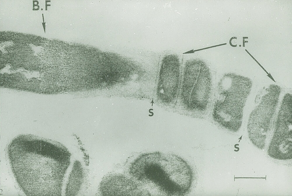 FIGURA 2: Corte de una cadena filamentosa de R. dentocariosa (48 horas), mostrando las formas cocoides (C.F) y las formas bacilares (B.F). También se distinguen los septos (S). (La barra representa 0,25 mm). Tomado de Roth y col.