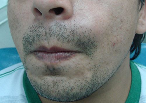Figura 1