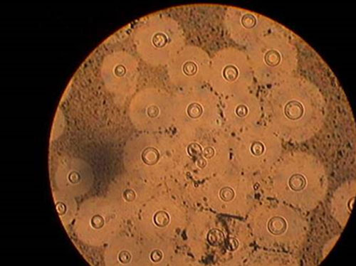 FIGURA 2 Criptococcus sp. en LCR (Cortesía Dra. Sofía Mata. Sección de Micología IMT)