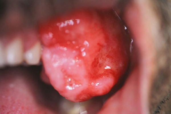 Figura 3 Aspecto intrabucal