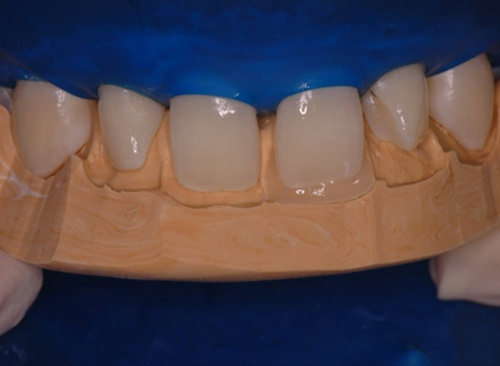 Figura 10