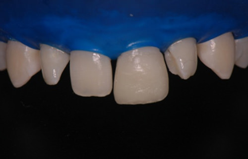 Figura 12