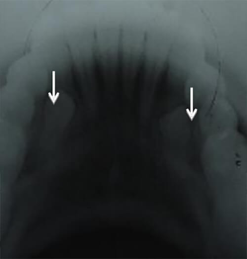 Imagen 2. Radiografía Oclusal