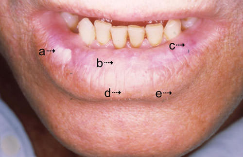 Figura 2