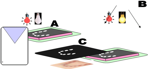 Fig. 8 Procesos para la oclusoradiografía: A: Una ves obtenido el oclusograma y estando dentro del cuarto oscuro, se saca una placa radiográfica oclusal de su sobre y se coloca debajo del oclusograma. B: Se incide brevemente la luz sobre el conjunto anterior y se revela tradicionalmente. C: Se superpone la radiografía sobre la foto original.