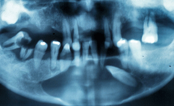 Figura 2 radiografía panorámica